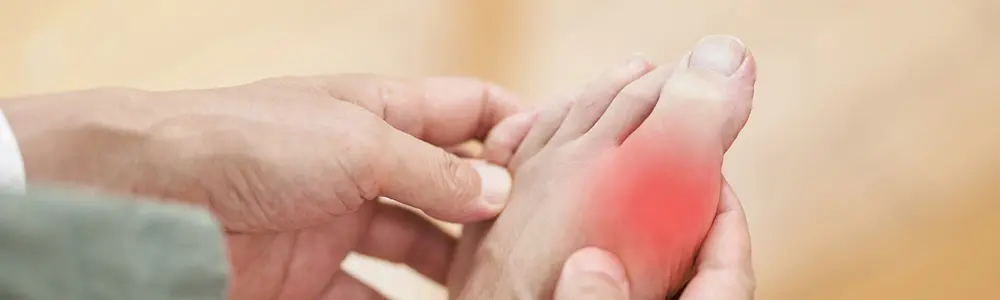From Gout to Glory: Rising Above Joint Pain